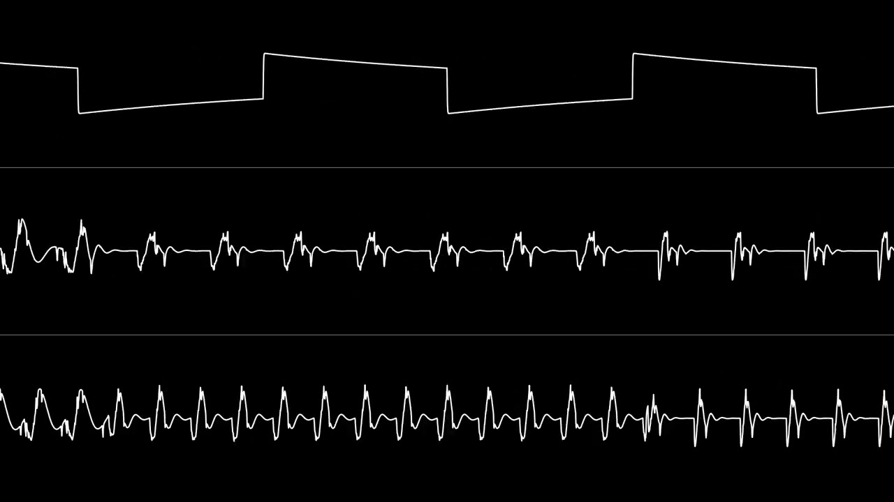 Jammer - “Alt Disco” (C64) [Oscilloscope View]