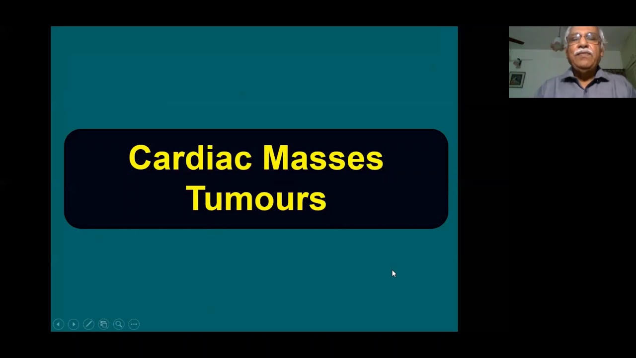 Echo Assessment in Cardiac Masses Dr  R  Alegesan Friday
