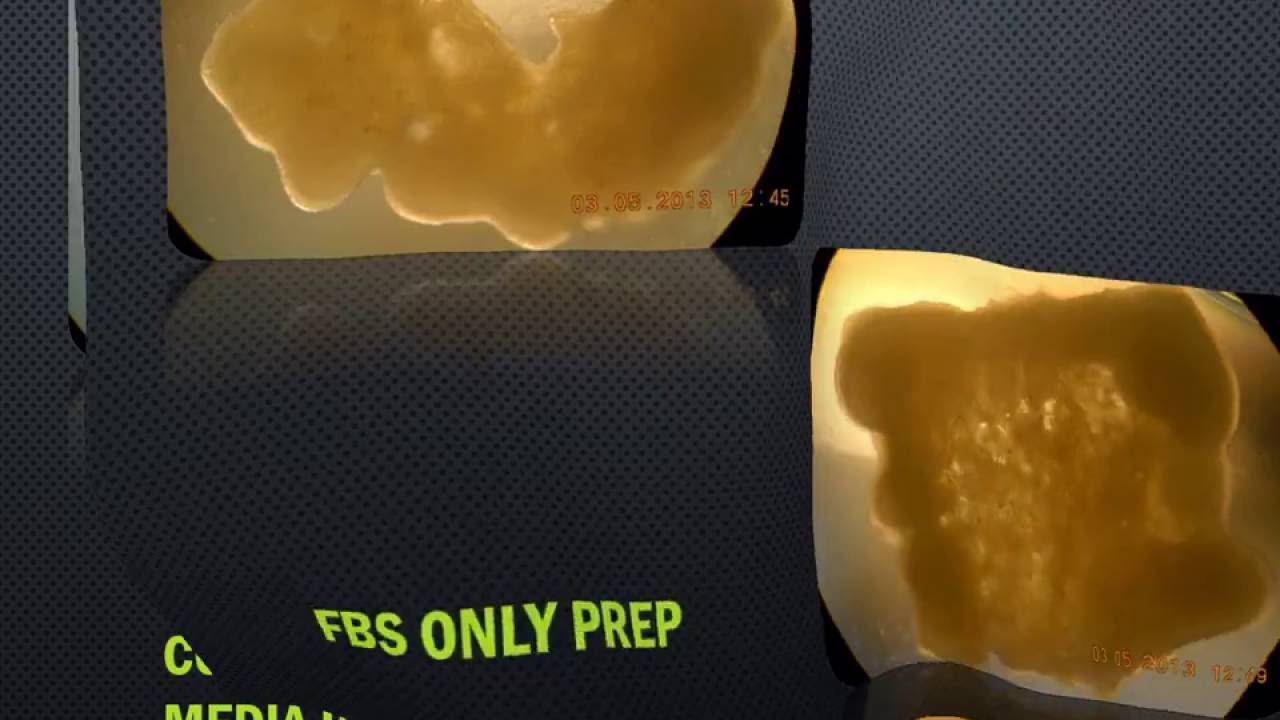 Long Term 3 Dimensional Cultures of HEK-293 Cells video