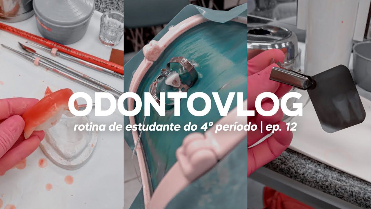 ODONTOVLOG #12: primeira radiografia e cirurgia de acesso (deu certo?) | Odonto Energy
