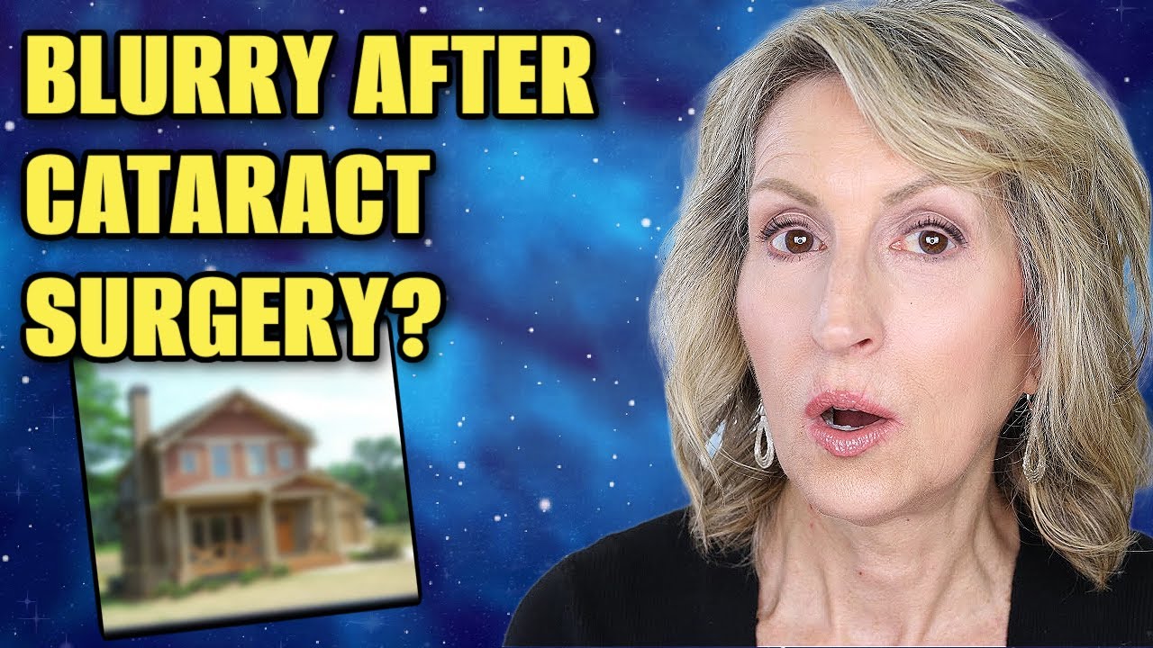 Blurry After Cataract Surgery? Here’s What You Need to Know! YAG Laser - Posterior Capsular Opacity
