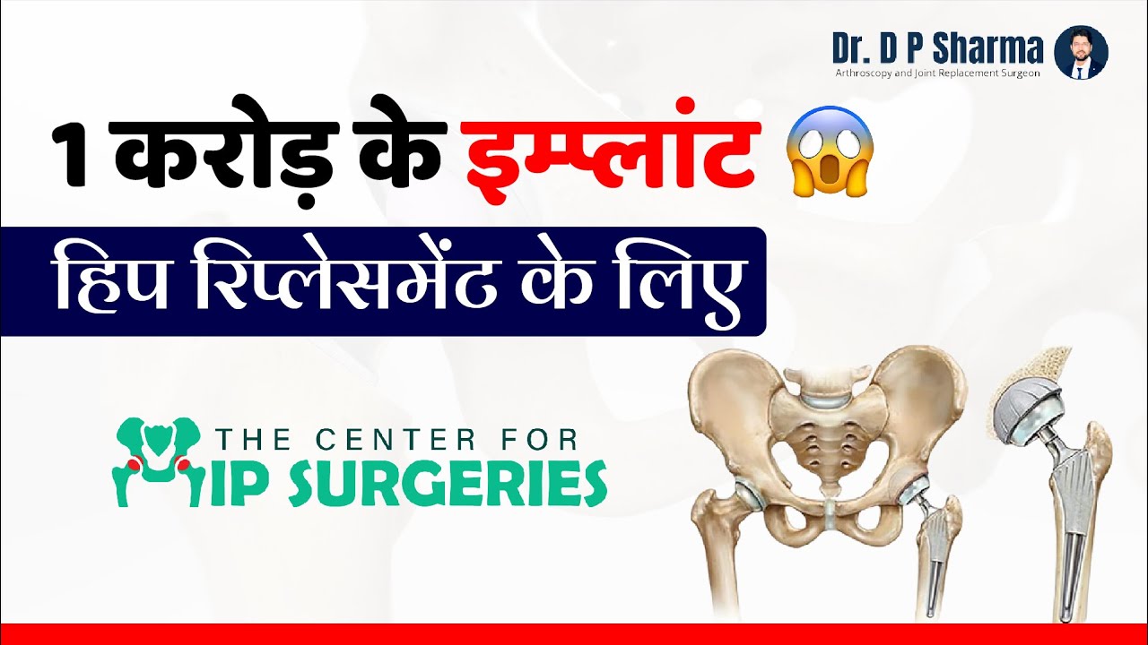 Implants of 1 Crore For Hip Replacement At The Center For Hip Surgeries, Delhi, INDIA - Dr DP Sharma