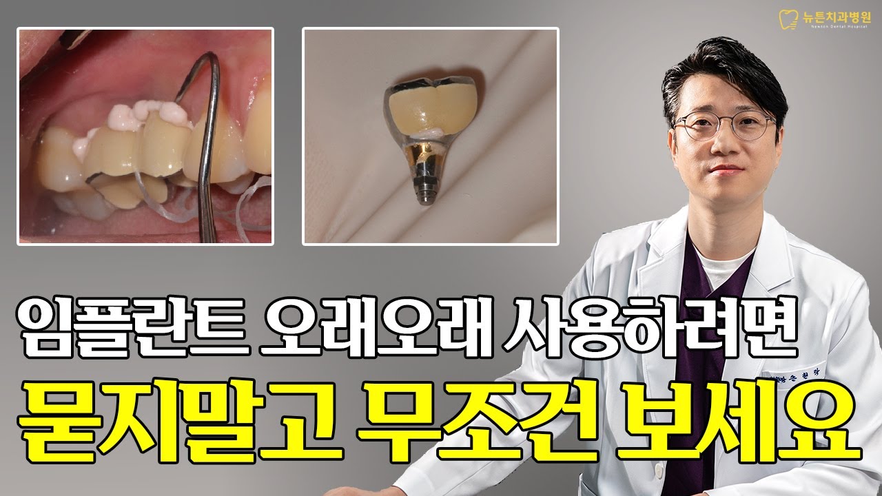 [부산전체임플란트] 구강내에 시멘트가? 임플란트 유지관리가 제일 중요한 이유 ?!