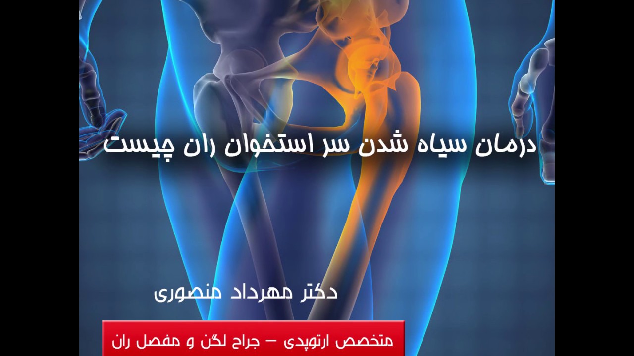 درمان سیاه شدن سر استخوان ران چیست