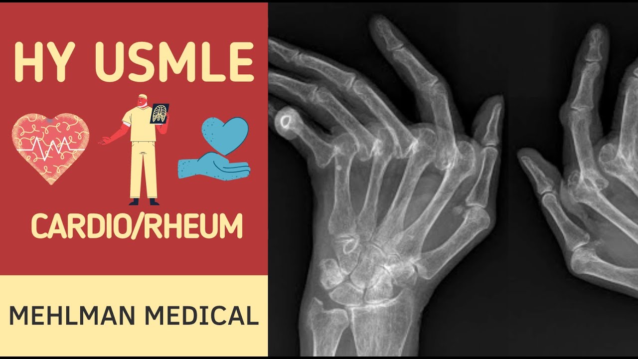 HY USMLE CARDIO-RHEUMATOLOGY - #239