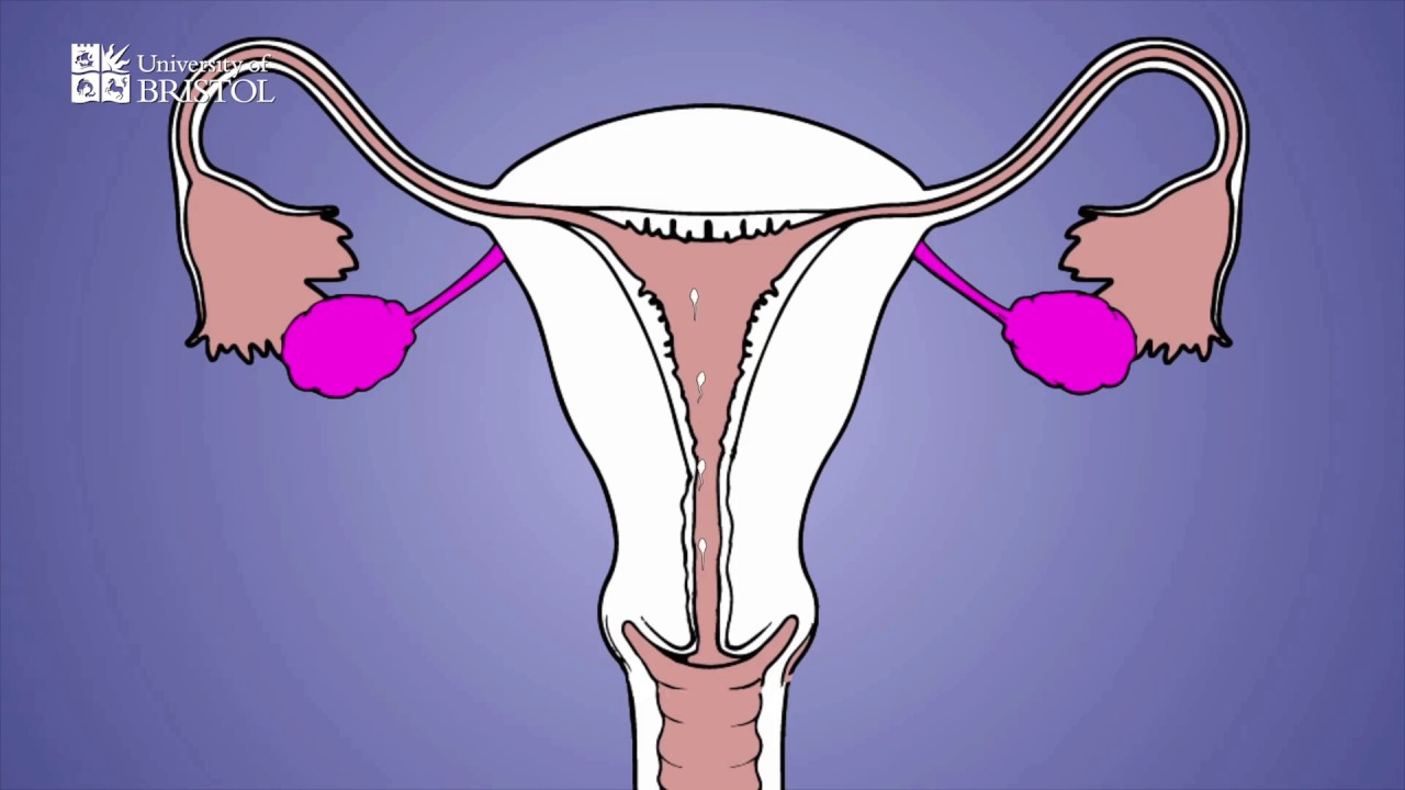 Contraceptive implant