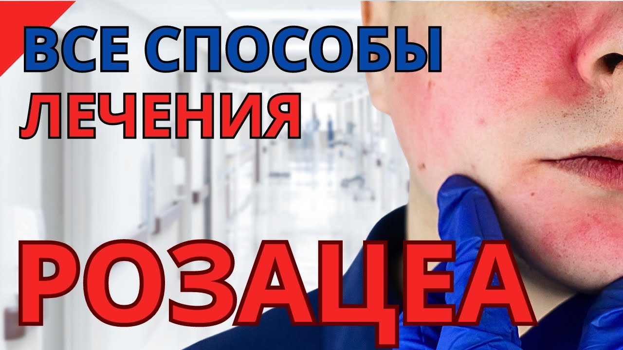 Розацеа: Эффективное лечение и уход за кожей! (Полное руководство от дерматолога)