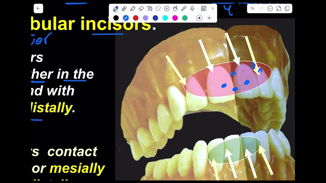 upper incisors || part1 