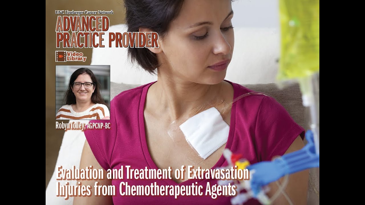 Evaluation and Treatment of Extravasation Injuries from Chemotherapeutic Agents -R. Tolley-20230622