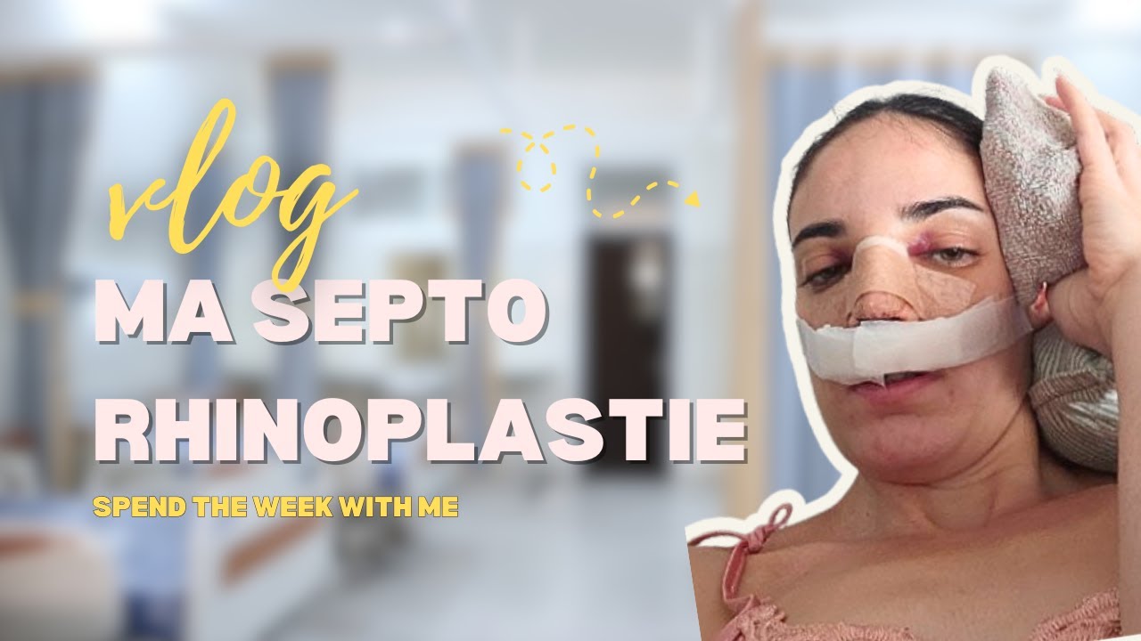 MA SEPTO RHINOPLASTIE