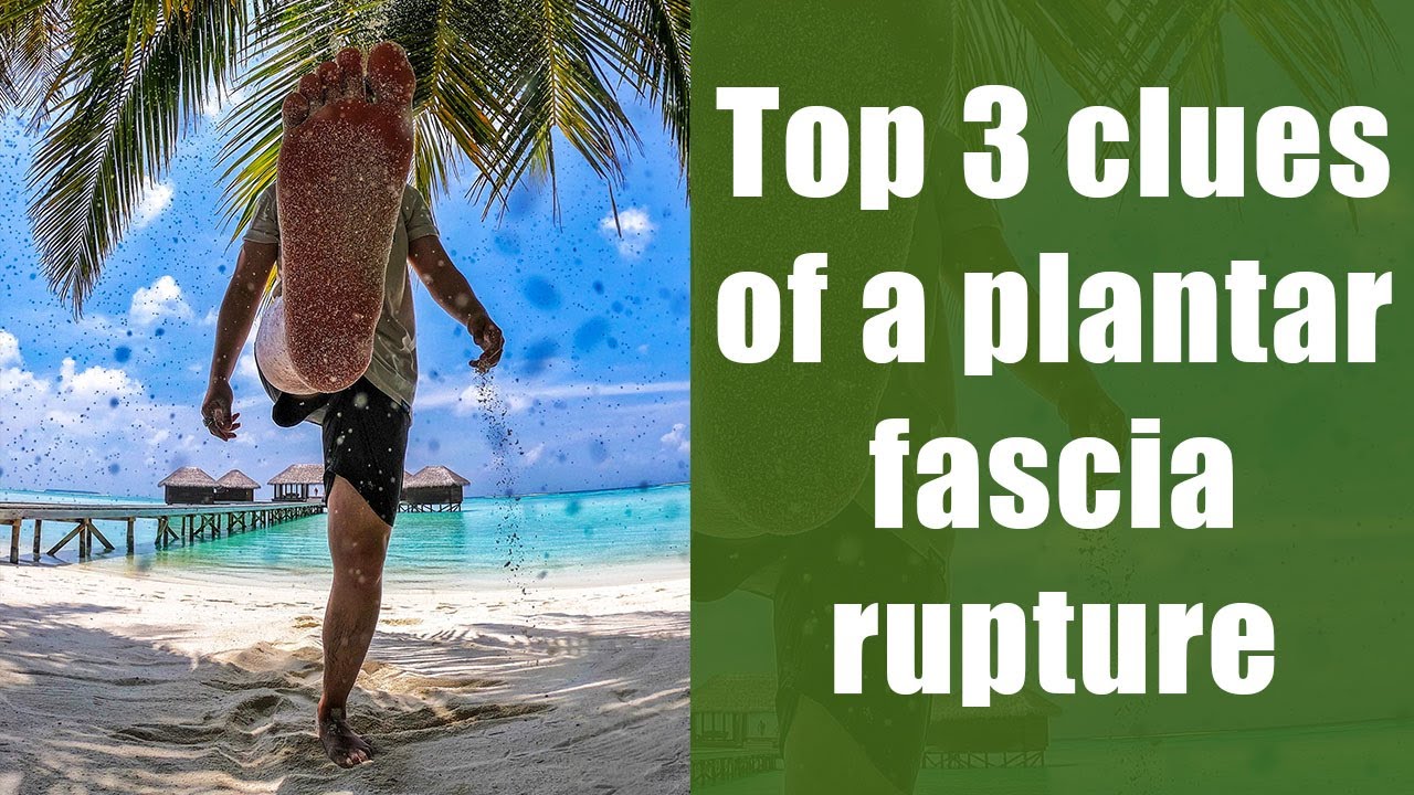 Top 3 clues of a plantar fascia rupture in a runner