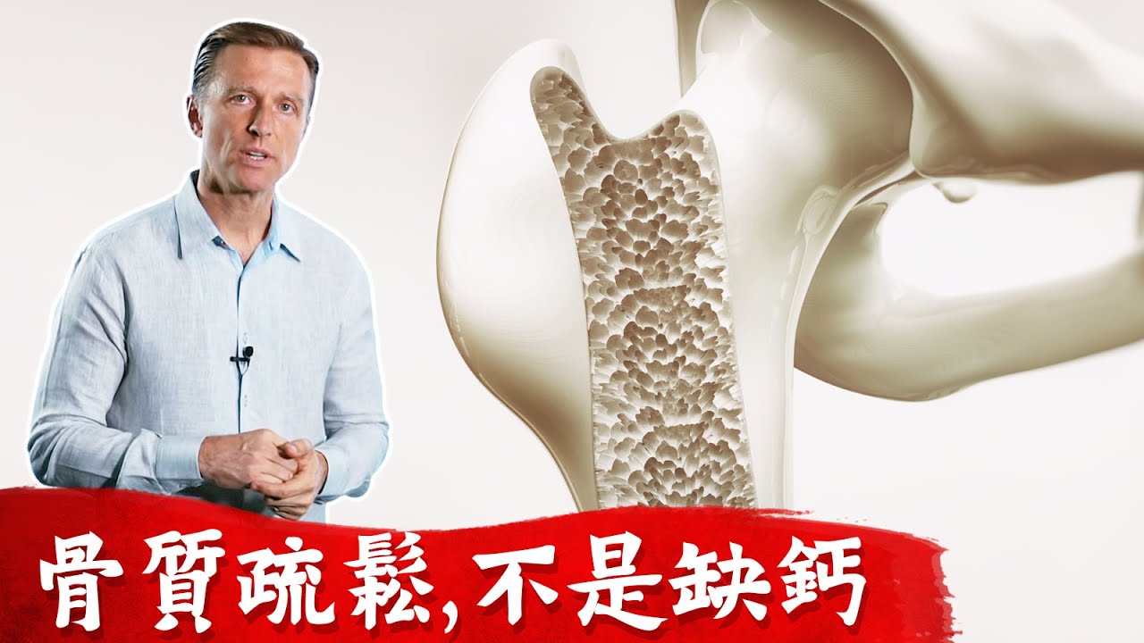 骨質疏鬆不是缺鈣,如何補救?柏格醫生 Dr Berg