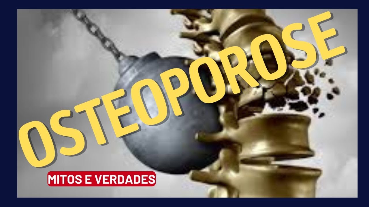 Osteoporose Mitos x Verdades