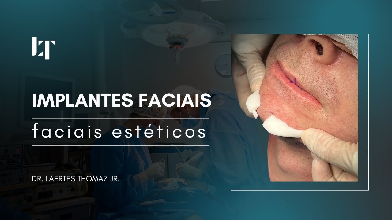 Implantes Faciais Estéticos