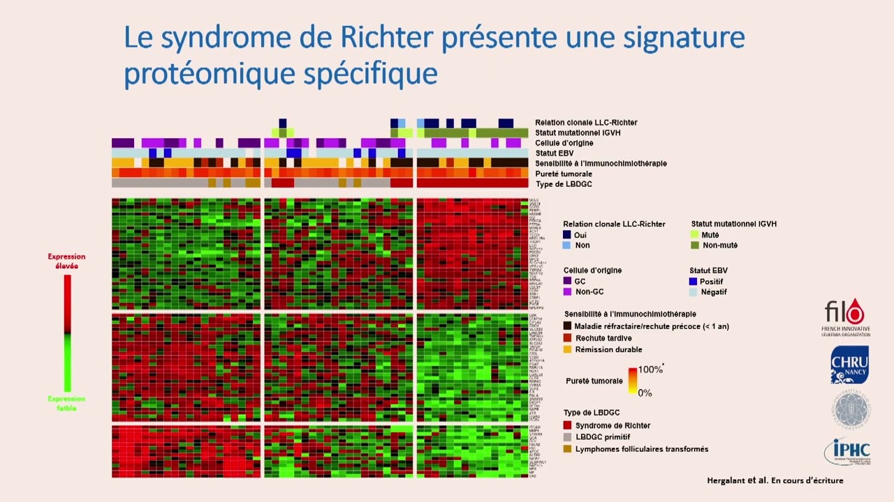 Journées AIH 2022 : le syndrome de Richter