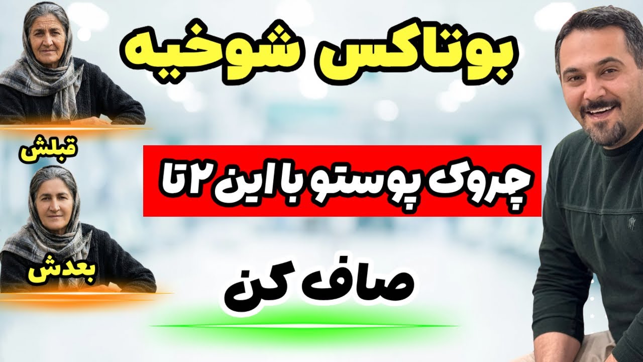 چروک پیشونی پیرت کرده؟ 🙃این دو حرکت ۵ سال جوونت می&zwnj;کنه! ⚡