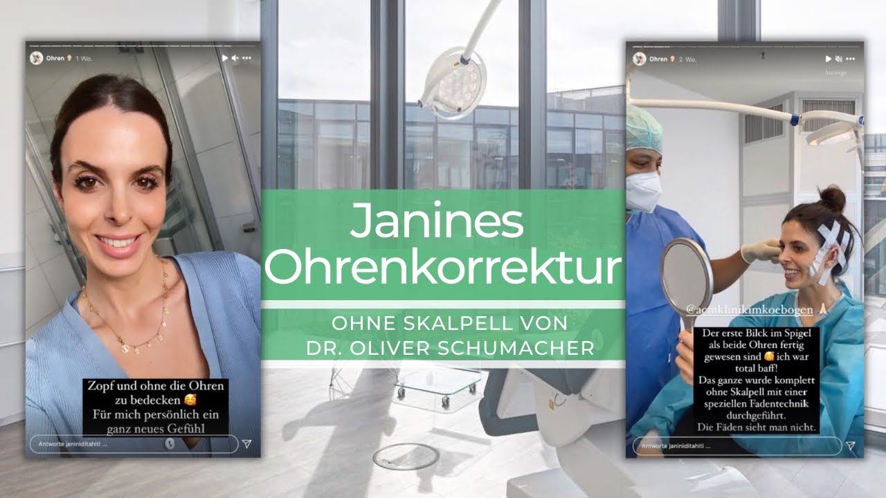 Janines Ohrenkorrektur: Abstehende Ohren Anlegen mit Fadenmethode (Ablauf & Kosten)