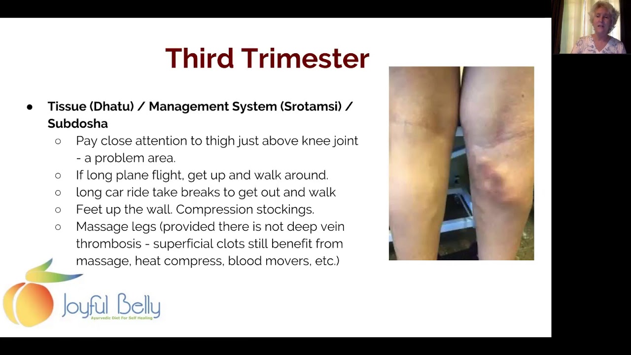 3rd Trimester - Stretch Marks, Varicose Veins, & Constipation: Ayurvedic Care for Pregnancy 4 of 6