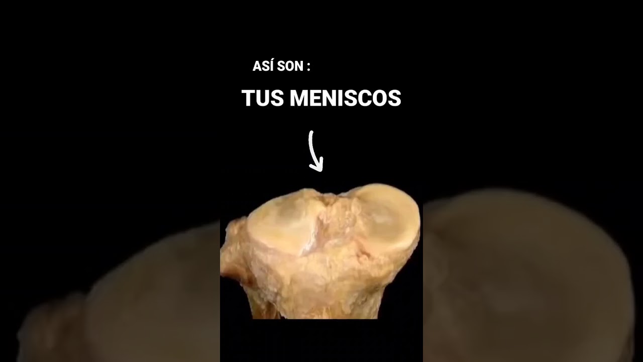 AS&Iacute; SON TUS MENISCOS 👀 #shorts #gym #medicina #rodilla