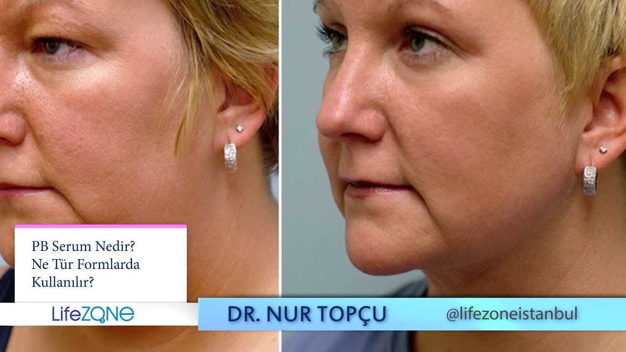 PB SERUM NEDİR?