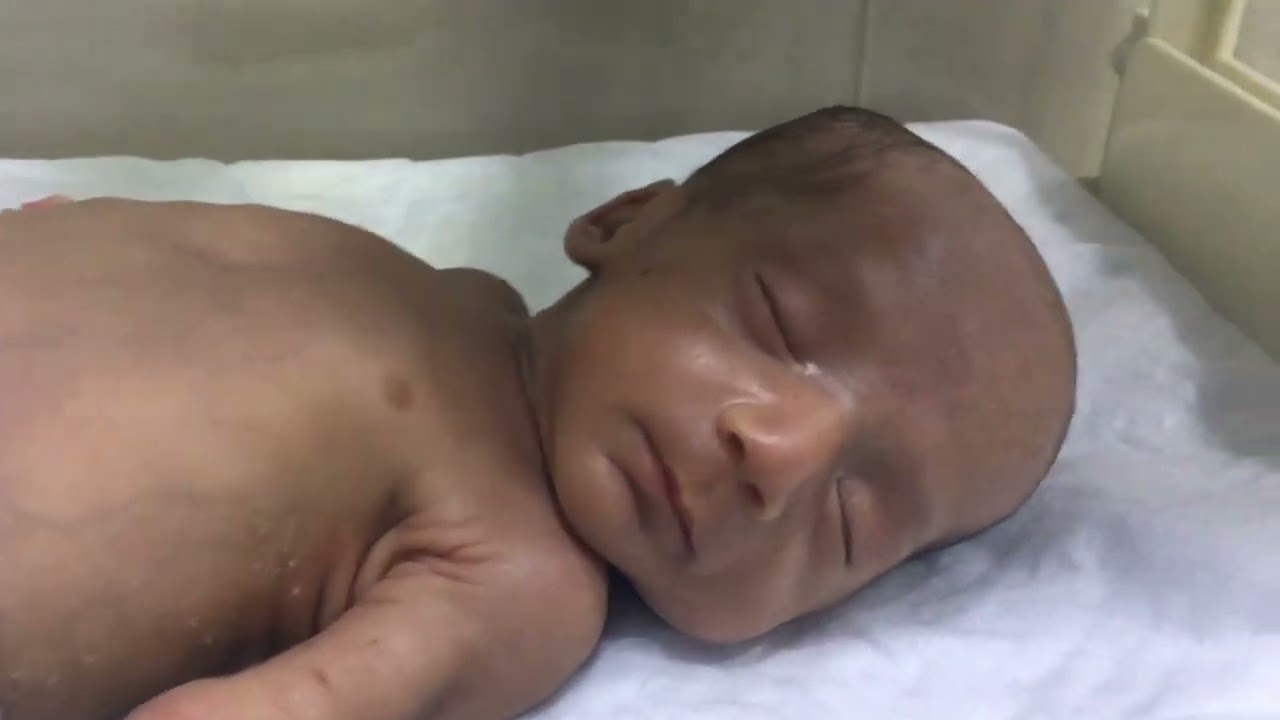 Newborn baby under observation || cute baby in inkebuter care #nicubabycare #cutebaby #observation 