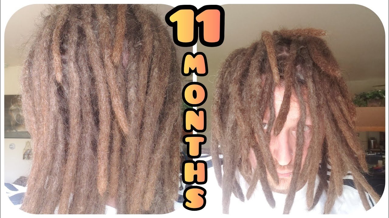 11 Month Dreadlock Update | Caucasian Straight Hair | Lots of Loose Hair
