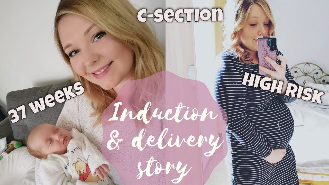 LABOUR & DELIVERY STORY | 37 Weeks, Failed Induction, C-section, High Risk