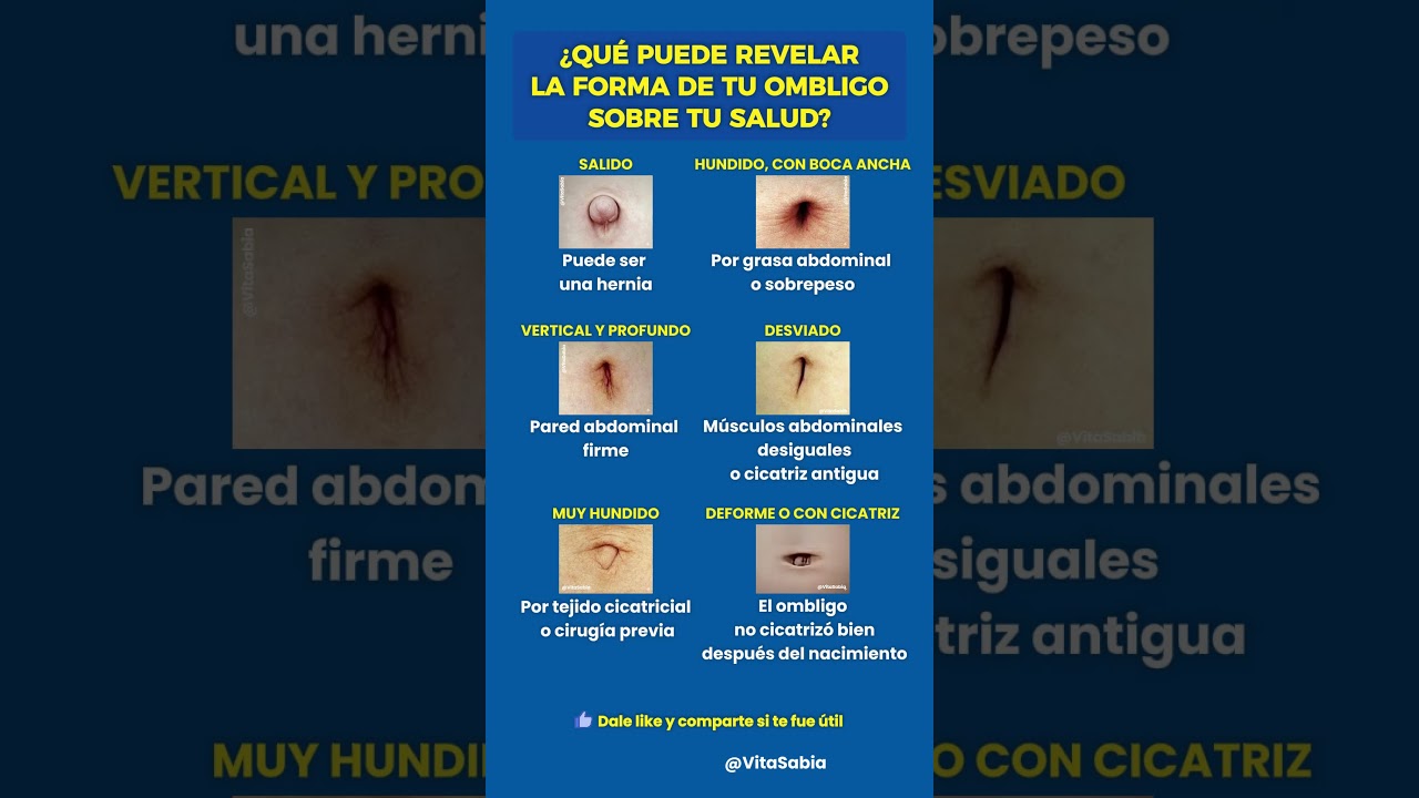 &iquest;QU&Eacute; PUEDE REVELAR LA FORMA DE TU OMBLIGO SOBRE TU SALUD?