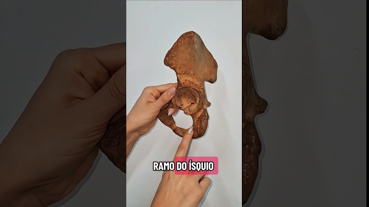 acidentes anatômicos do quadril 