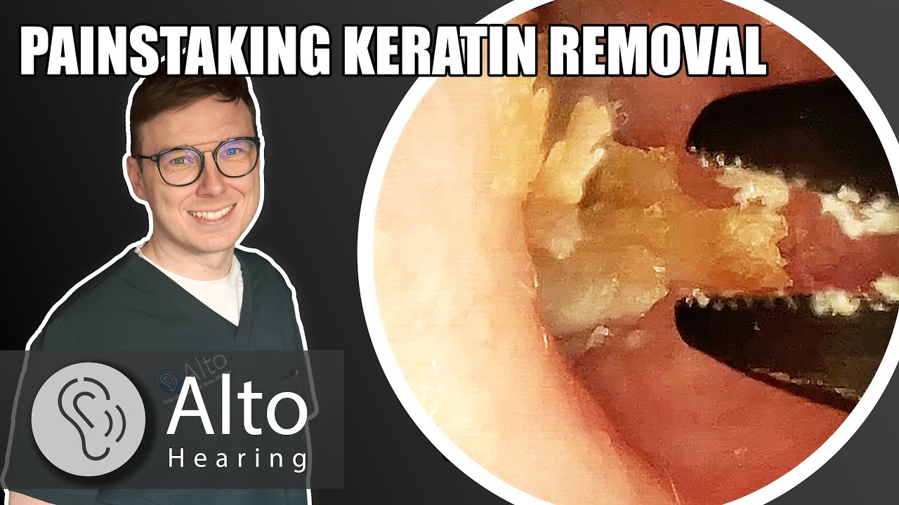 Pain, Psoriasis, and Ear Wax: A Delicate Extraction #013