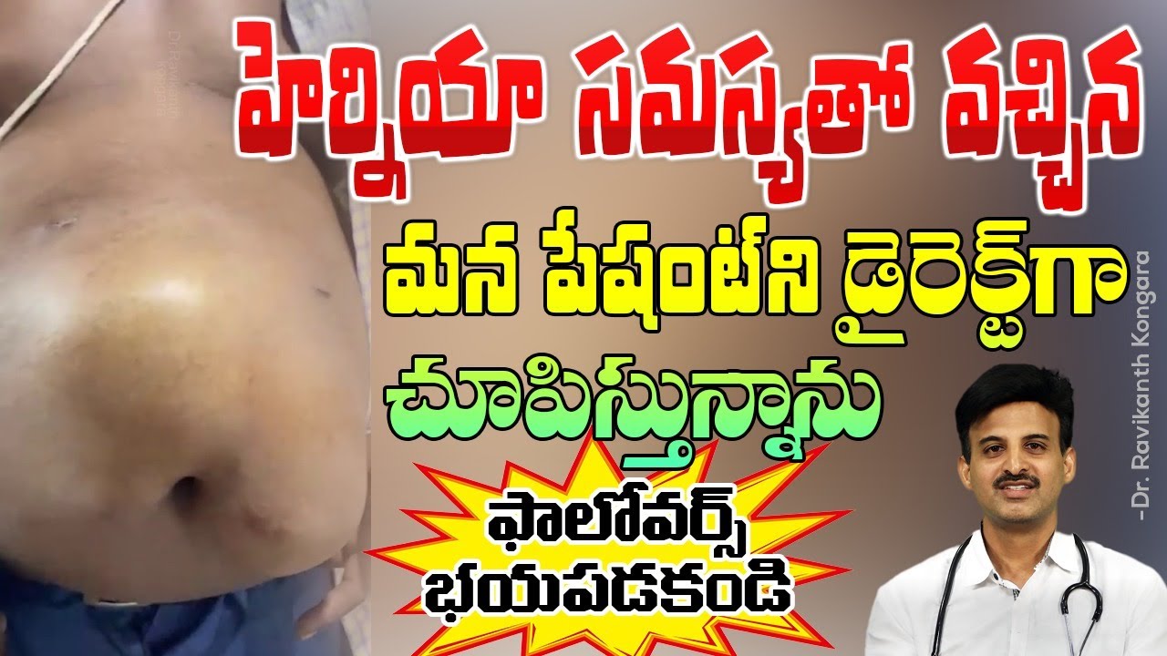 3 Main Causes of Hernia | Different Types of Hernia | Last Stages of Hernia | Dr. Ravikanth Kongara