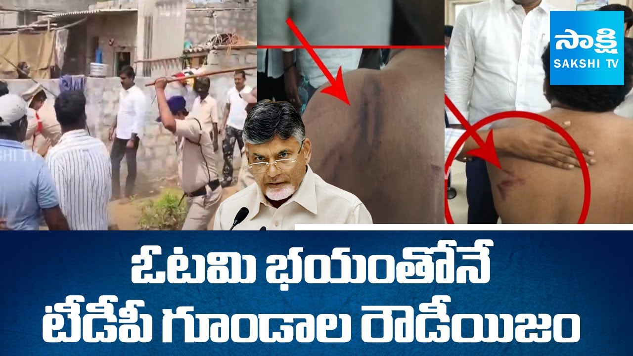 TDP Goons attack on YSRCP Leaders | Chandrababu Govt Conspiracy | @sakshitv