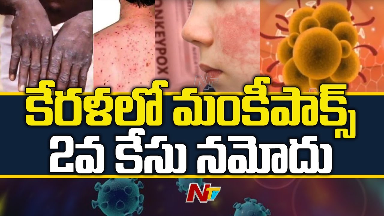 Monkeypox Second Case Reported in Kerala | Ntv