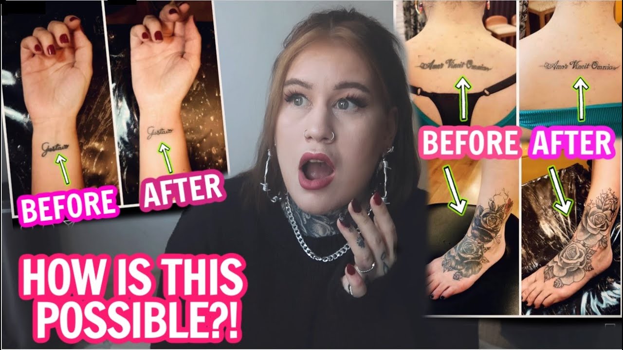 Fixing Blown Out Tattoos With No Laser ??