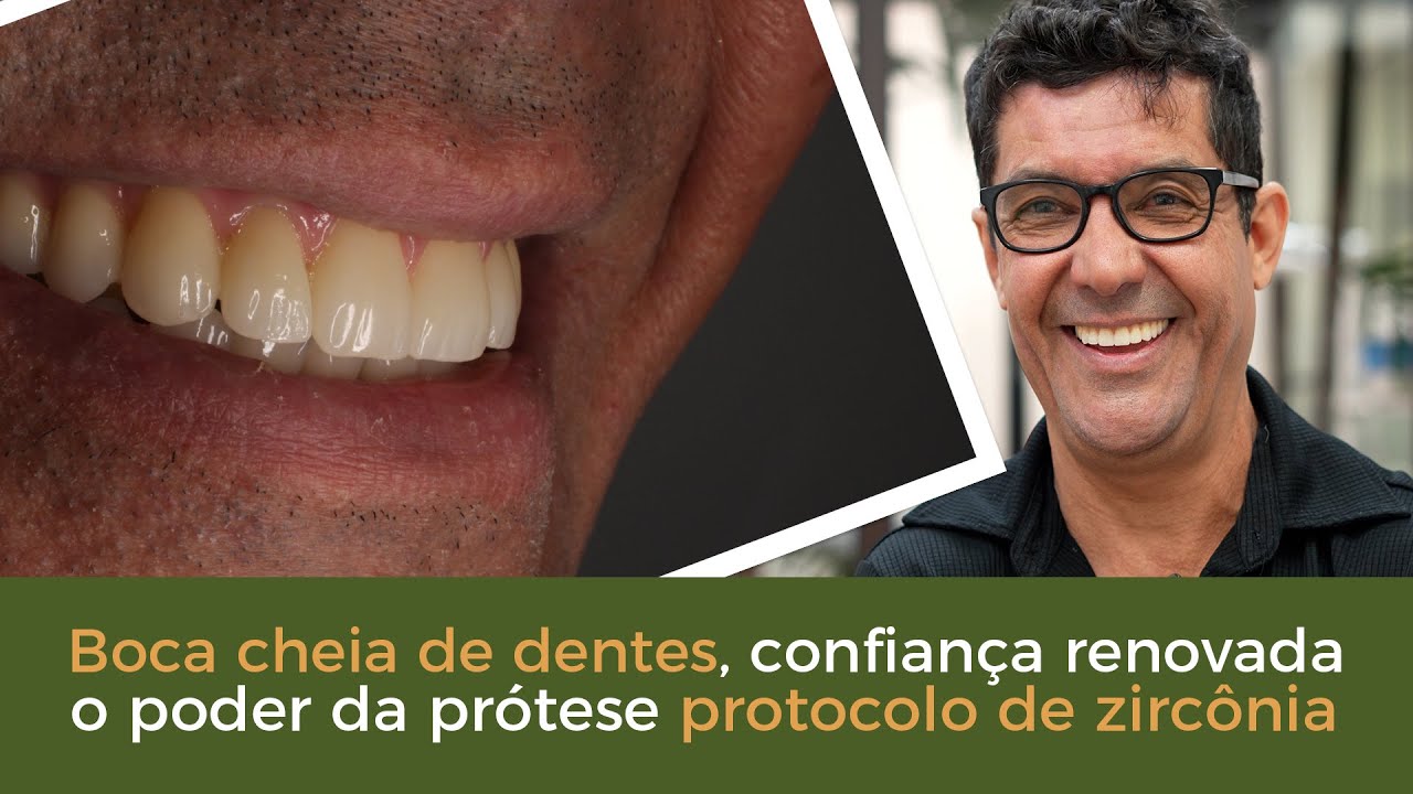 Mastigar Sem Medo, A Transforma&ccedil;&atilde;o Com a Pr&oacute;tese Protocolo de Zirc&ocirc;nia - Implace Implantes
