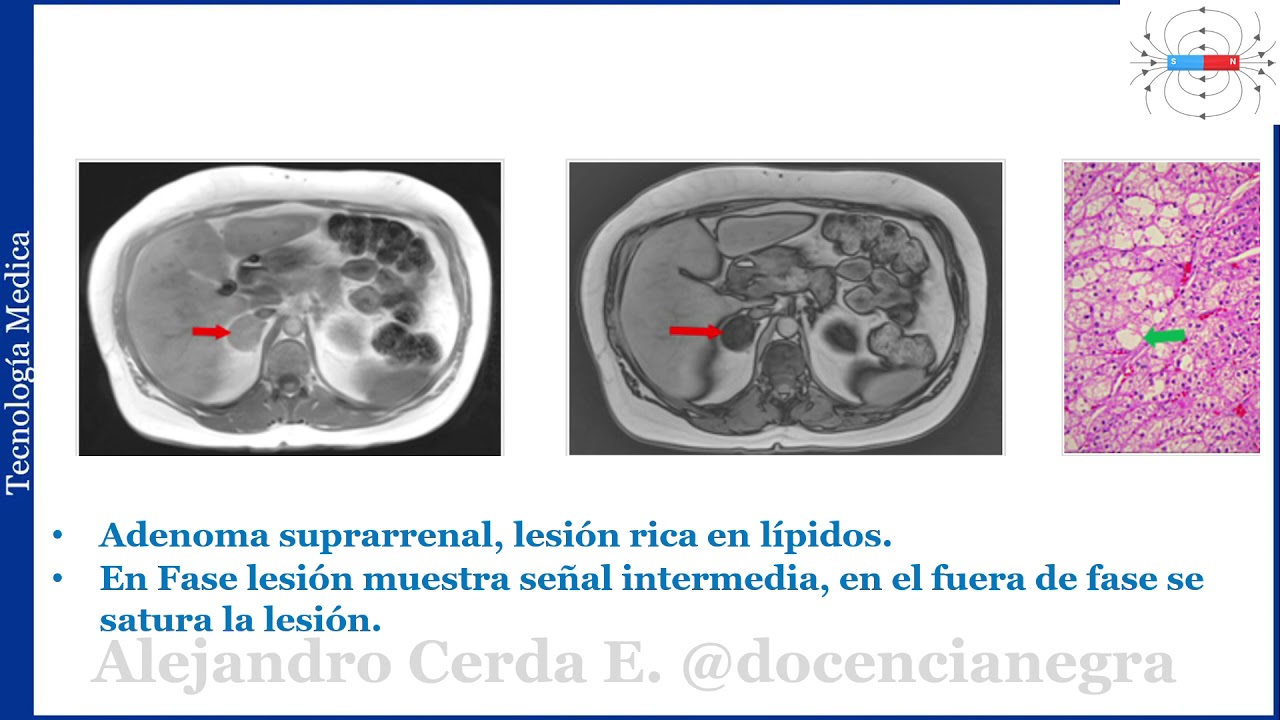 CLASE MECANISMOS DE SATURACION TISULAR PT1