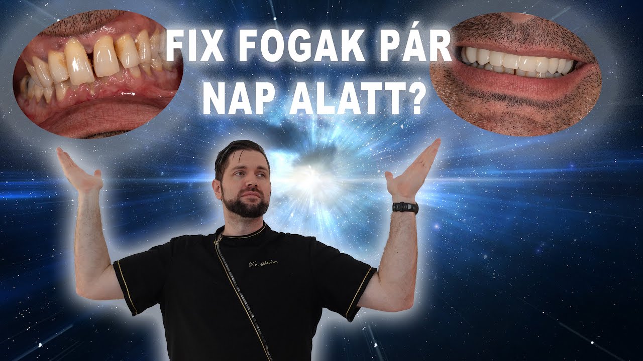 Fix fogak p&aacute;r nap alatt?