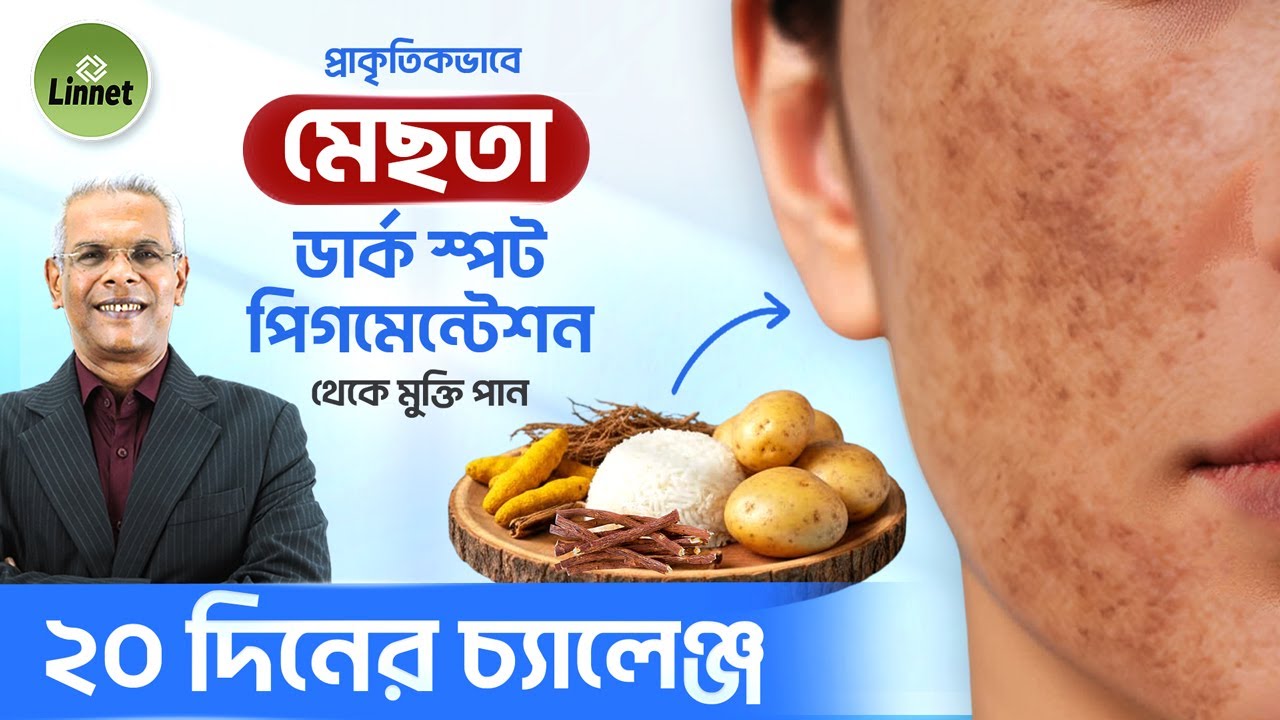 মেছতার দাগ ও ত্বকের কালচে ভাব দূর করুন । Scientifically Proven Natural Remedies for Glowing Skin