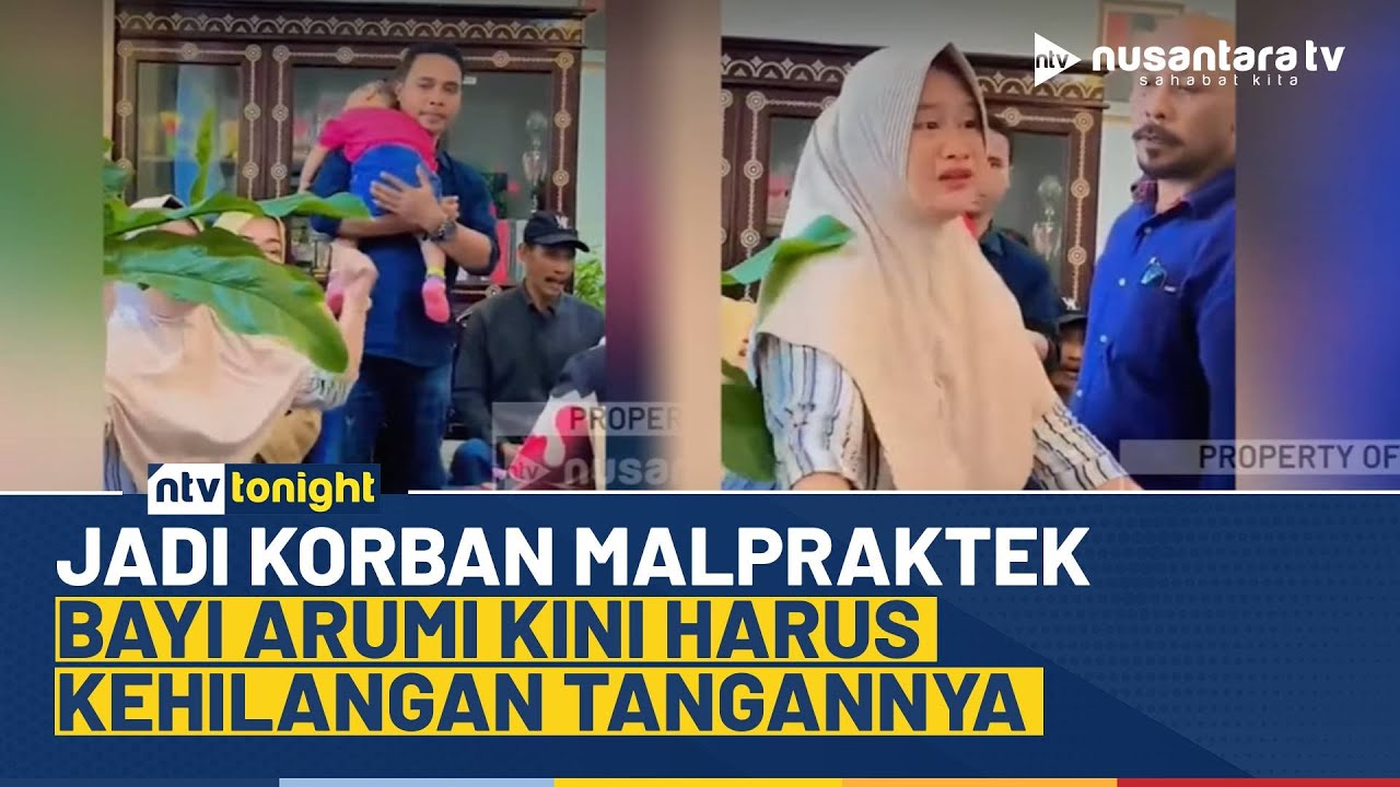 Pilu! Diduga Jadi Korban Malpraktek, Bayi Arumi Harus Kehilangan Tangan Kanannya I NTV TONIGHT