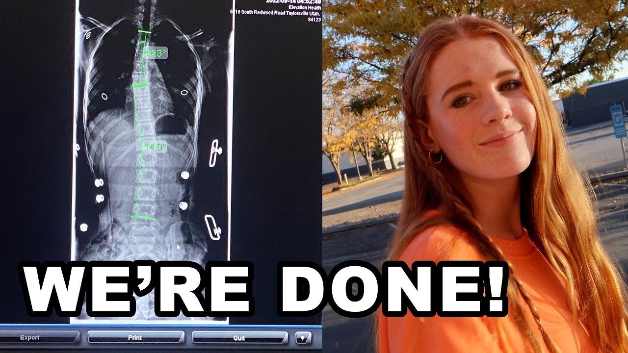 Ambree's last scoliosis appointment.  (went bad)