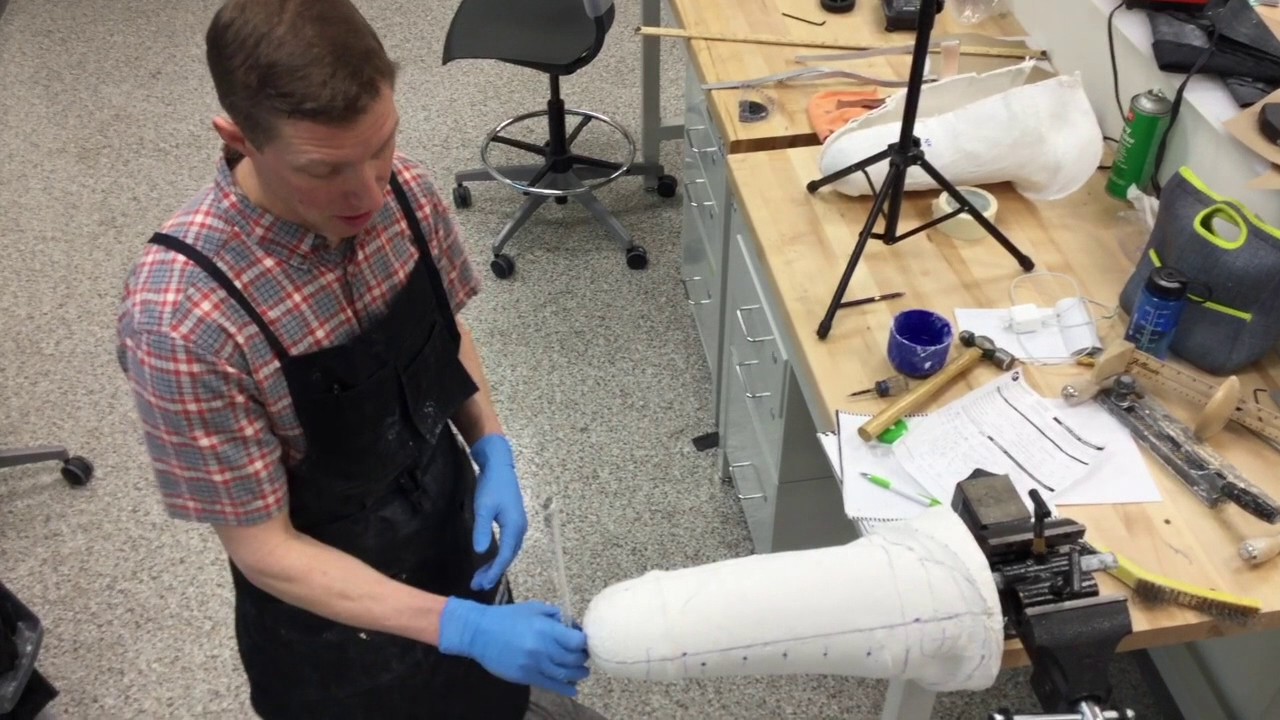 Transfemoral Cast Modification Part 1