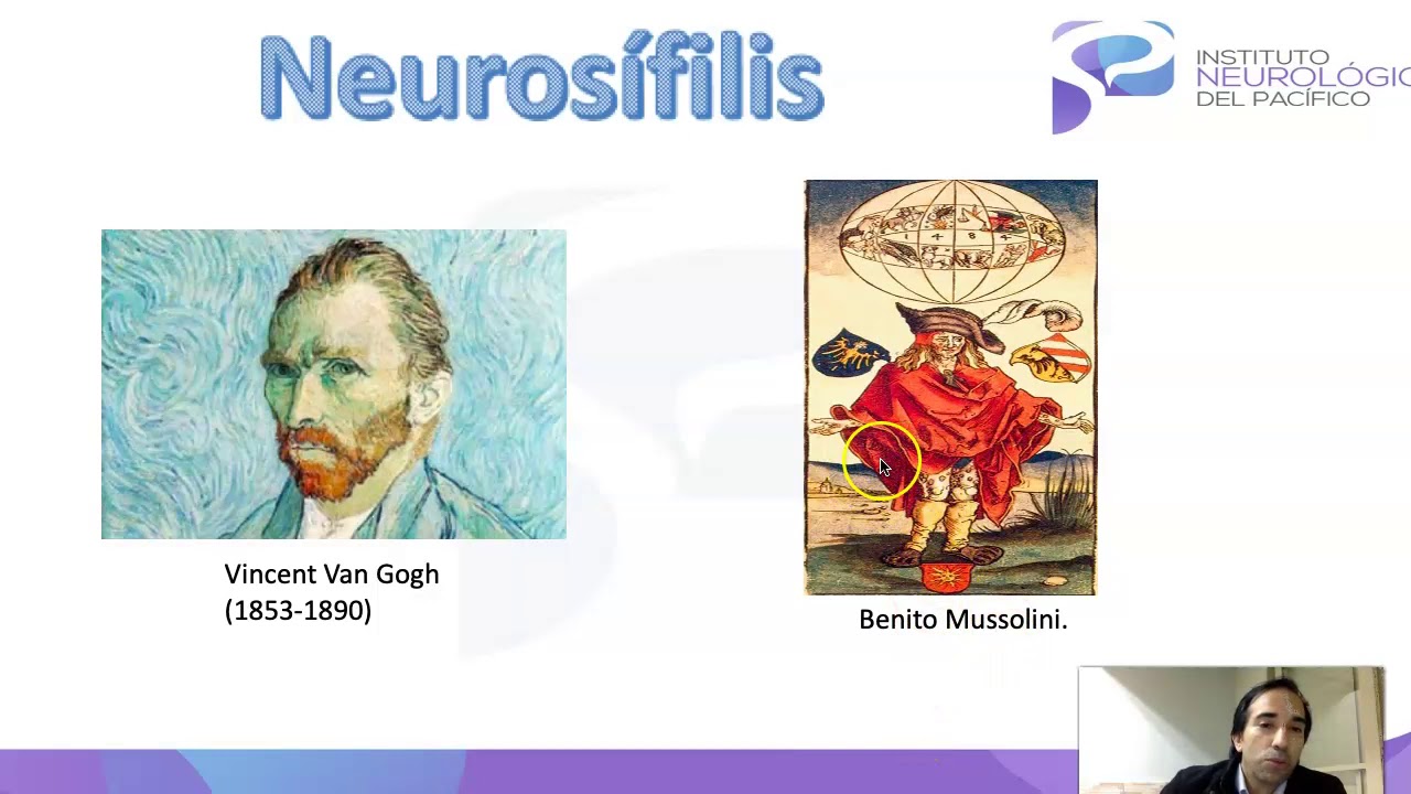 Neurosifilis la Gran simuladora: lo que debes saber.