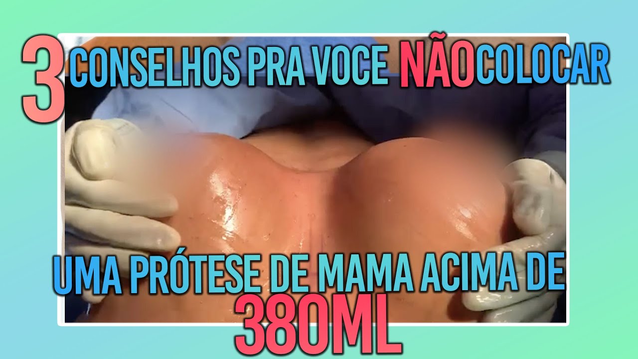 3 CONSELHOS PRA VOCE NAO COLOCAR UMA PRÓTESE DE MAMA ACIMA DE 380ML- CIRURGIA PLÁSTICA