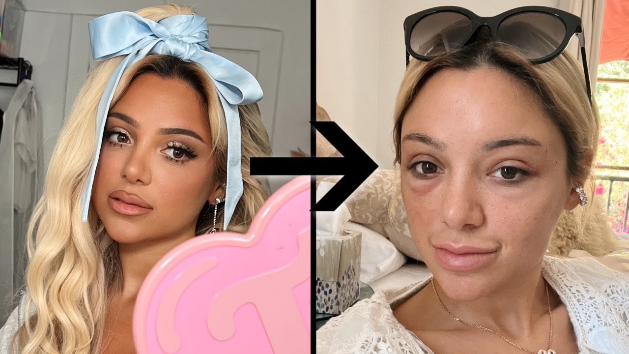 so i got plastic surgery during retrograde... (chaotic weekly vlog)