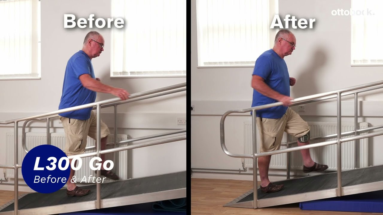 See the difference Bioness L300 Go makes to Brin's gait | Ottobock