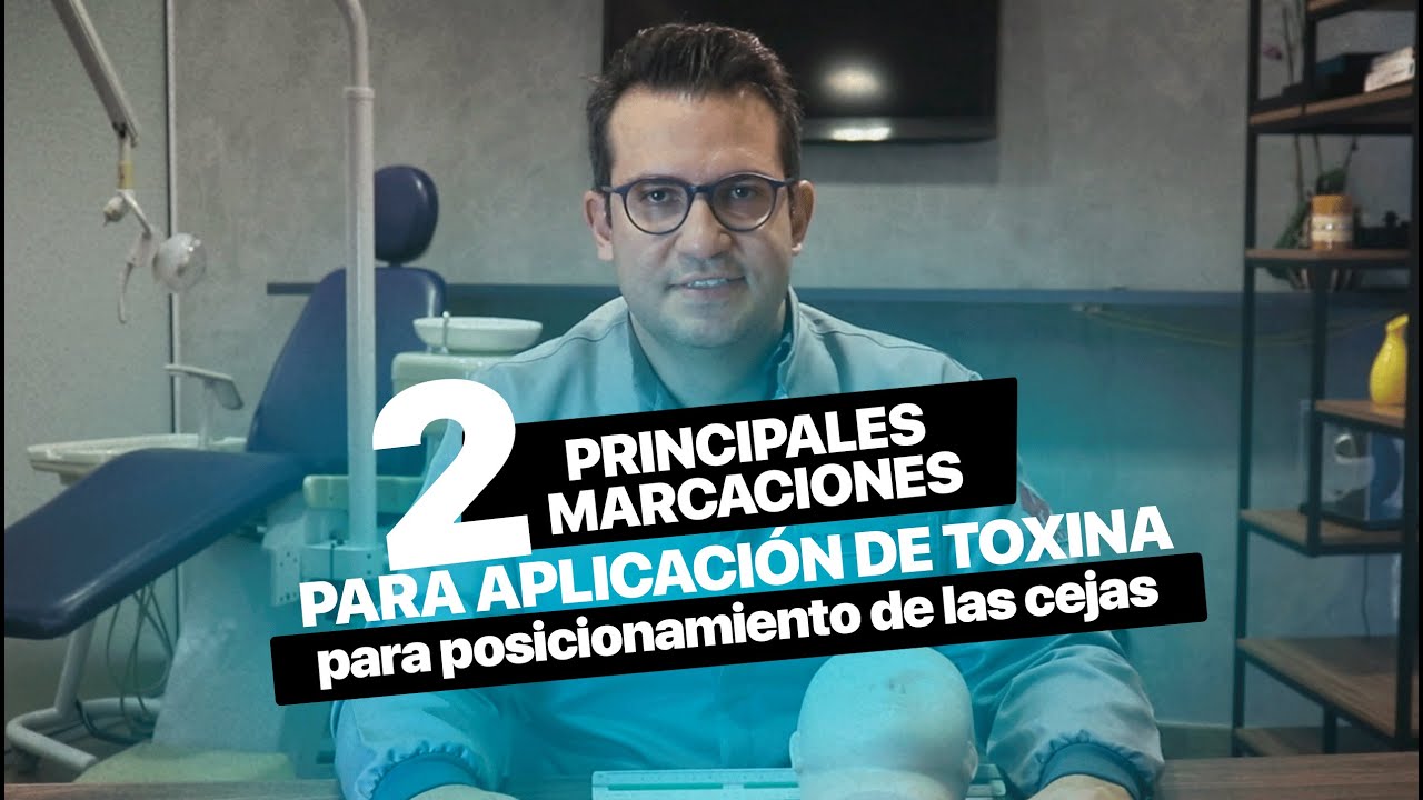 Posicionamento de las cejas: 2 Marcaciones para aplicación de toxina