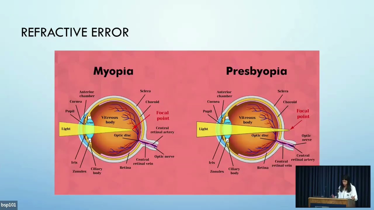 Specialty and Medically Necessary Contact Lenses