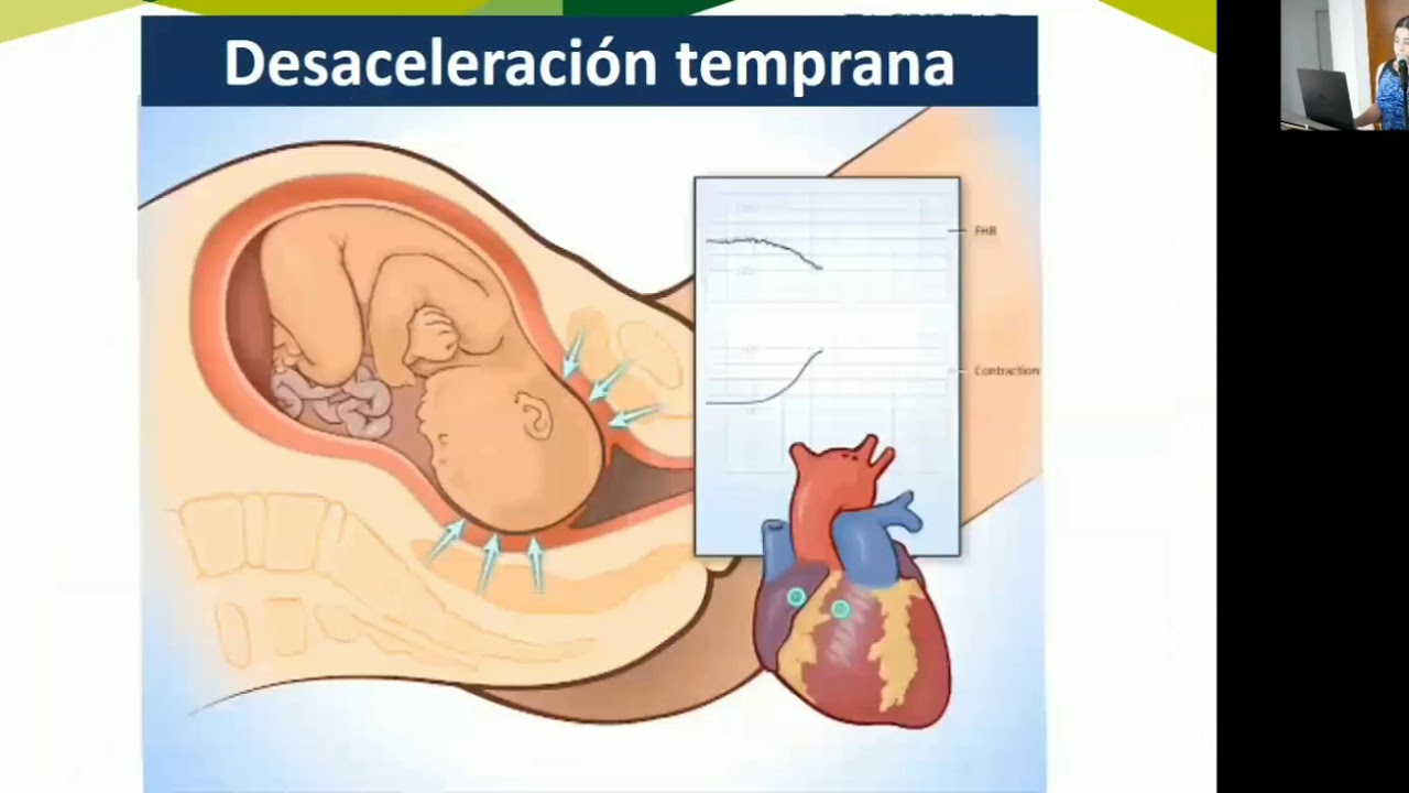 Monitoreo fetal academia medicina