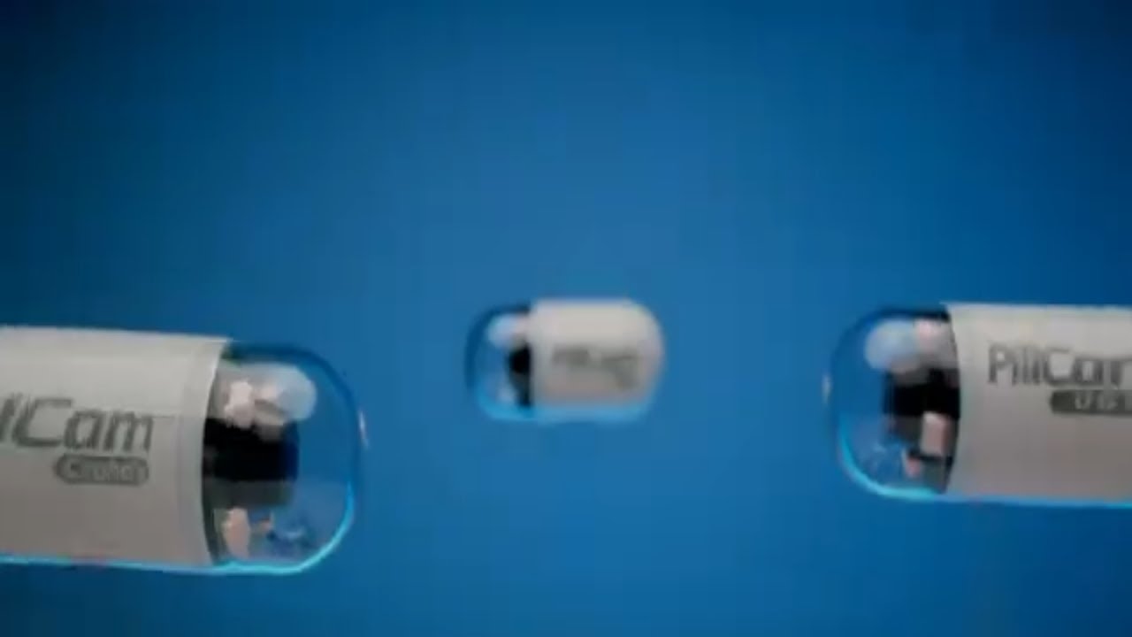 PillCam&trade; Capsule Endoscopy &ndash; Turning the Impossible Into Reality