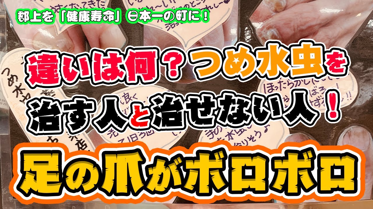 【つめ水虫】有料級！2000人の足を見てきた薬剤師がお教えします。治せる人と治せない方の違いは・・・それは、塗る回数と足を〇〇をしているかどうかなんです。【郡上の保健室  カトー薬局】